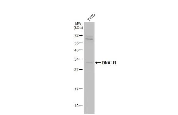 Western Blot: DNALI1 Antibody [NBP2-16197] - Whole cell extract (30 ug) was separated by 12% SDS-PAGE, and the membrane was blotted with DNALI1 antibody (NBP2-16197) diluted at 1:1000. The HRP-conjugated anti-rabbit IgG antibody  was used to detect the primary antibody, and the signal was developed with Trident ECL plus-Enhanced.