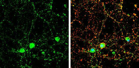 Immunocytochemistry/ Immunofluorescence Doc2-alpha Antibody