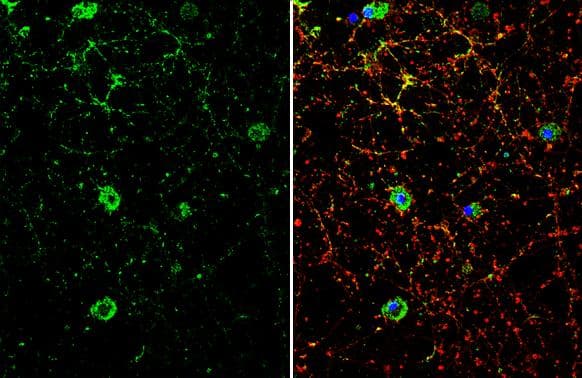 Immunocytochemistry/ Immunofluorescence Dopamine D1R/DRD1 Antibody - BSA Free
