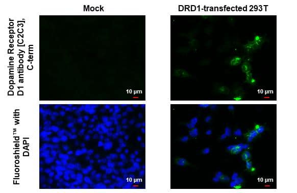 Immunocytochemistry/ Immunofluorescence Dopamine D1R/DRD1 Antibody - BSA Free