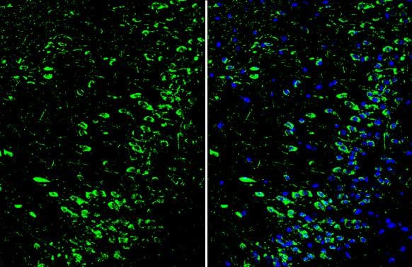 Immunohistochemistry-Frozen Dopamine D1R/DRD1 Antibody - BSA Free