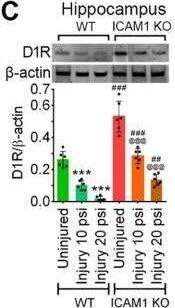 ICAM-1 reduces neurotransmitters expression that reflects in sensorimotor deficits and psychological stress after TBI. A, Immunofluorescent staining of NE (red) in the hippocampus area of WT and ICAM-1−/− mice after 10 and 20 psi FPI and merged with NeuN (green) and DAPI (blue). Scale bar: 20 μm (all panels). B, Quantification of NE staining in the hippocampus area of uninjured, 10 and 20 psi FPI WT and ICAM-1−/− mice using ImageJ software (n = 6/group). C–E, Western blot analysis of 5-HT1AR (C), DAD1R (D), NPY (E) and  beta -actin in the tissue lysates of hippocampus of WT and ICAM-1−/− mice 48 h after 10 and 20 psi FPI. The bar graph with dot plots shows the quantification of 5-HT1AR (C), DAD1R (D), NPY (E) versus  beta -actin (n = 6/group). F, Schematic presentation of the findings. All values are expressed as mean +/- SD two-way ANOVA followed by Bonferroni post hoc tests. Statistically significant ***p < 0.001 versus WT uninjured group; @@@p < 0.001 versus uninjured ICAM-1−/− group; #p < 0.05, ##p < 0.01, ###p < 0.001 versus WT corresponding injury groups; ns = non-significant. NE, norepinephrine; 5-HT1AR, 5-HT 1A receptor; DAD1R, DA D1 receptor; NPY, neuropeptide Y. Image collected and cropped by CiteAb from the following open publication (//pubmed.ncbi.nlm.nih.gov/34135004), licensed under a CC-BY license. Not internally tested by Novus Biologicals.