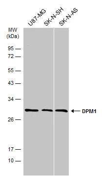 Various whole cell extracts (30 ug) were separated by 12% SDS-PAGE, and the membrane was blotted with DPM1 antibody [N1C2] (NBP2-16220) diluted at 1:500. The HRP-conjugated anti-rabbit IgG antibody  was used to detect the primary antibody. 