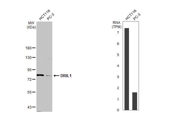 Various whole cell extracts (30 ug) were separated by 7.5% SDS-PAGE, and the membrane was blotted with DRIL1 antibody (NBP2-16228) diluted at 1:1000. The HRP-conjugated anti-rabbit IgG antibody  was used to detect the primary antibody. Corresponding RNA expression data for the same cell lines are based on Human Protein Atlas program. 