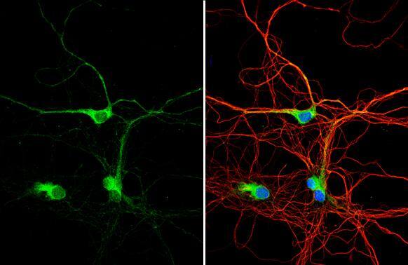 Dysbindin antibody detects Dysbindin protein by immunofluorescent analysis.Sample: DIV9 rat E18 primary hippocampal neuron cells were fixed in 4% paraformaldehyde at RT for 15 min.Green: Dysbindin stained by Dysbindin antibody (NBP2-16245) diluted at 1:500.Red: beta Tubulin 3/ Tuj1, stained by beta Tubulin 3/ Tuj1 antibody [GT11710]  diluted at 1:500.Blue: Fluoroshield with DAPI . 