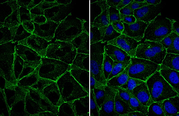 Immunocytochemistry/ Immunofluorescence: E-Cadherin Antibody [NBP2-16258] - E-Cadherin antibody detects E-Cadherin protein at cell membrane by immunofluorescent analysis.Sample: MDCK cells were fixed in 4% paraformaldehyde at RT for 15 min.Green: E-Cadherin stained by E-Cadherin antibody (NBP2-16258) diluted at 1:500.