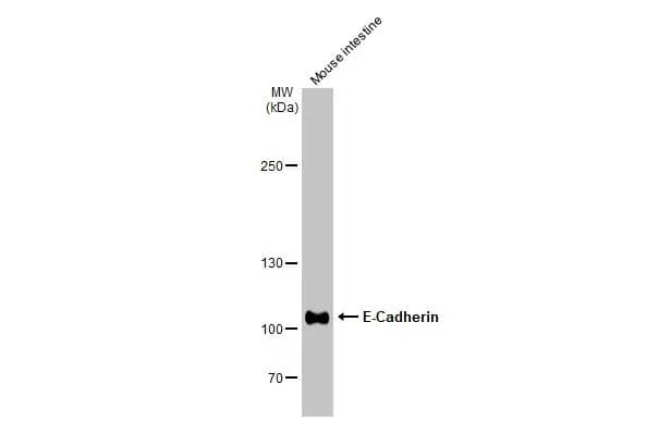 Western Blot: E-Cadherin Antibody [NBP2-16258] - Mouse tissue extract (50 ug) was separated by 5% SDS-PAGE, and the membrane was blotted with E-Cadherin antibody (NBP2-16258) diluted at 1:2000. The HRP-conjugated anti-rabbit IgG antibody  was used to detect the primary antibody.