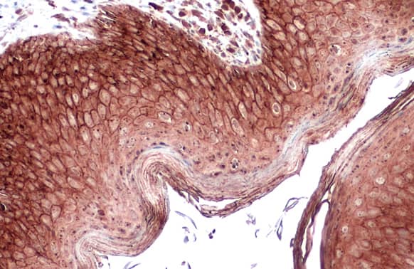 Immunohistochemistry-Paraffin: E-Cadherin Antibody [NBP2-16258] - E-Cadherin antibody detects E-Cadherin protein at cell membrane and cytoplasm by immunohistochemical analysis.Sample: Paraffin-embedded dog skin.E-Cadherin stained by E-Cadherin antibody (NBP2-16258) diluted at 1:500.Antigen Retrieval: Citrate buffer, pH 6.0, 15 min