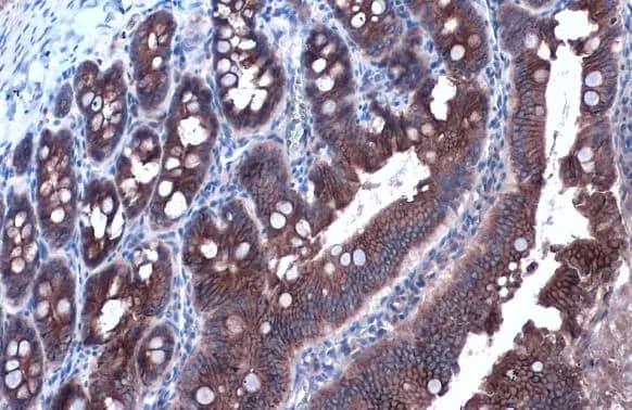 Immunohistochemistry-Paraffin: E-Cadherin Antibody [NBP2-16258] - E-Cadherin antibody detects E-Cadherin protein at cell membrane and cytoplasm by immunohistochemical analysis.Sample: Paraffin-embedded rat duodenum.E-Cadherin stained by E-Cadherin antibody (NBP2-16258) diluted at 1:1000.Antigen Retrieval: Citrate buffer, pH 6.0, 15 min