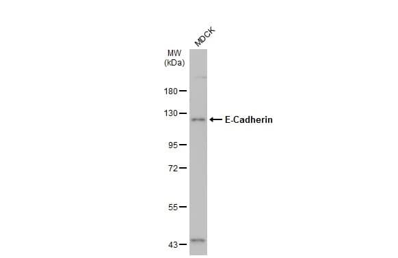 Western Blot: E-Cadherin Antibody [NBP2-16258] - Whole cell extracts (30 ug) was separated by 7.5% SDS-PAGE, and the membrane was blotted with E-Cadherin antibody (NBP2-16258) diluted at 1:10000. The HRP-conjugated anti-rabbit IgG antibody  was used to detect the primary antibody.