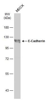 Western Blot: E-Cadherin Antibody [NBP2-16258] - Whole cell extract (30 ug) was separated by 7.5% SDS-PAGE, and the membrane was blotted with E-Cadherin antibody (NBP2-16258) diluted at 1:7000. The HRP-conjugated anti-rabbit IgG antibody  was used to detect the primary antibody.