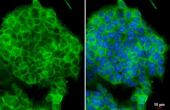 Immunocytochemistry/ Immunofluorescence: E-Cadherin Antibody [NBP2-16258] - E-Cadherin antibody detects E-Cadherin protein at cell membrane by immunofluorescent analysis.Sample: HCT116 cells were fixed in 4% paraformaldehyde at RT for 15 min.Green: E-Cadherin stained by E-Cadherin antibody (NBP2-16258) diluted at 1:500.Blue: Fluoroshield with DAPI .Scale bar= 10 um.