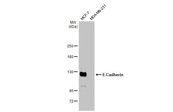 Western Blot: E-Cadherin Antibody [NBP2-16258] - Various whole cell extracts (30 ug) were separated by 5% SDS-PAGE, and the membrane was blotted with E-Cadherin antibody (NBP2-16258) diluted at 1:2000. The HRP-conjugated anti-rabbit IgG antibody  was used to detect the primary antibody.