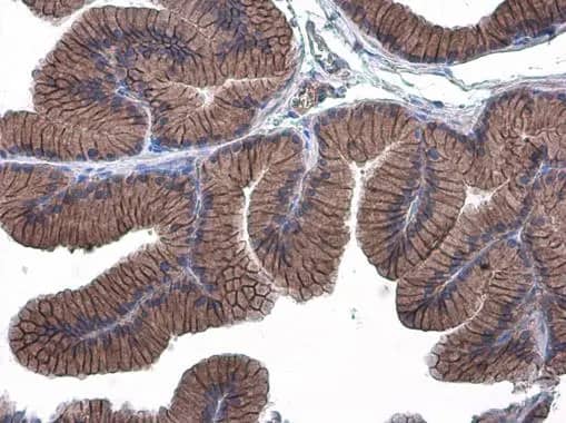 Immunohistochemistry-Paraffin: E-Cadherin Antibody [NBP2-16258] - E-Cadherin antibody detects E-Cadherin protein at cell membrane in rat prostate by immunohistochemical analysis. Sample: Paraffin-embedded rat prostate. E-Cadherin antibody (NBP2-16258) diluted at 1:500.Antigen Retrieval: Citrate buffer, pH 6.0, 15 min