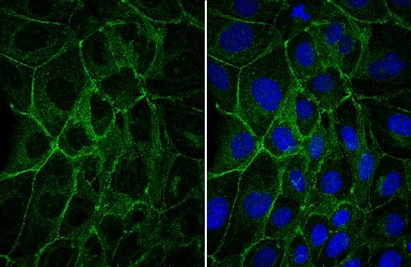E-Cadherin antibody detects E-Cadherin protein at cell membrane by immunofluorescent analysis.Sample: MDCK cells were fixed in 4% paraformaldehyde at RT for 15 min.Green: E-Cadherin stained by E-Cadherin antibody (NBP2-16258) diluted at 1:500. 