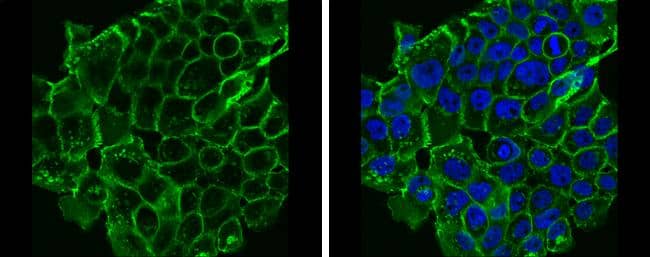 E-Cadherin antibody detects E-Cadherin protein at cell membrane by immunofluorescent analysis.Sample: A431 cells were fixed in 4% paraformaldehyde at RT for 15 min.Green: E-Cadherin protein stained by E-Cadherin antibody (NBP2-16258) diluted at 1:500.Blue: Hoechst 33342 staining. 
