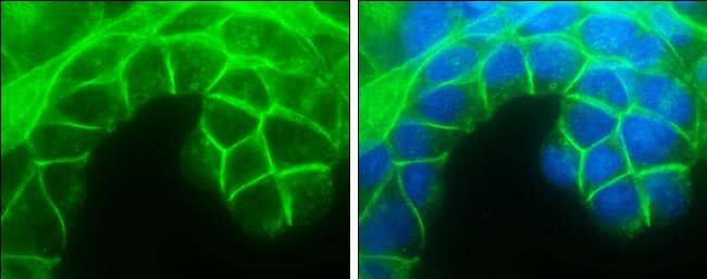 E-Cadherin antibody detects E-Cadherin protein at cell membrane by immunofluorescent analysis.Sample: MCF7 cells were fixed in 4% paraformaldehyde at RT for 15 min.Green: E-Cadherin protein stained by E-Cadherin antibody (NBP2-16258) diluted at 1:500.Blue: Hoechst 33342 staining. 