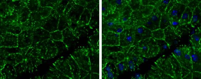 E-Cadherin antibody detects E-Cadherin protein at cell membrane in mouse pancreas by immunohistochemical analysis. Sample: Paraffin-embedded mouse pancreas. E-Cadherin antibody (NBP2-16258) diluted at 1:400.Antigen Retrieval: Citrate buffer, pH 6.0, 15 min 