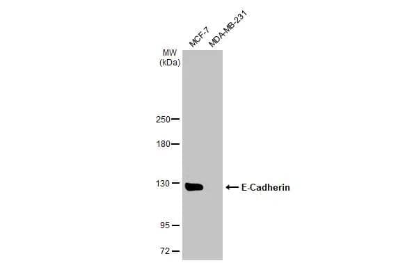 Various whole cell extracts (30 ug) were separated by 5% SDS-PAGE, and the membrane was blotted with E-Cadherin antibody (NBP2-16258) diluted at 1:2000. The HRP-conjugated anti-rabbit IgG antibody  was used to detect the primary antibody. 
