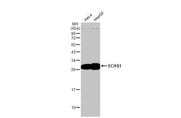 Western Blot: ECHS1 Antibody [NBP2-16263] - Various whole cell extracts (30 ug) were separated by 12% SDS-PAGE, and the membrane was blotted with ECHS1 antibody [N1C2] (NBP2-16263) diluted at 1:500. The HRP-conjugated anti-rabbit IgG antibody  was used to detect the primary antibody.