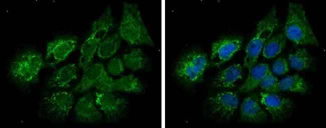 Immunocytochemistry/ Immunofluorescence ECHS1 Antibody - BSA Free