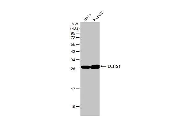 Western Blot: ECHS1 Antibody [NBP2-16264] - Various whole cell extracts (30 ug) were separated by 12% SDS-PAGE, and the membrane was blotted with ECHS1 antibody (NBP2-16264) diluted at 1:500. The HRP-conjugated anti-rabbit IgG antibody  was used to detect the primary antibody.