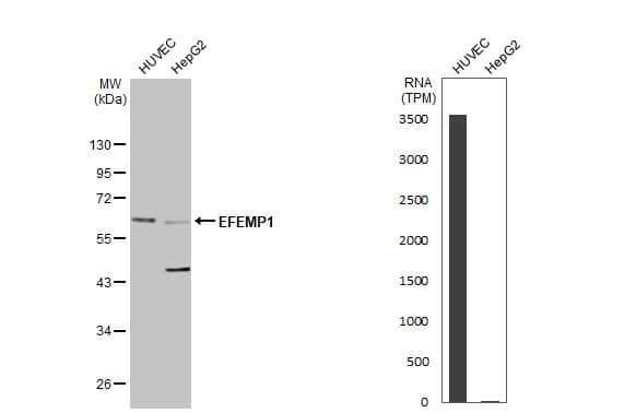 Various whole cell extracts (50 ug) were separated by 10% SDS-PAGE, and the membrane was blotted with EFEMP1 antibody (NBP2-16277) diluted at 1:1000. The HRP-conjugated anti-rabbit IgG antibody  was used to detect the primary antibody, and the signal was developed with Trident ECL plus-Enhanced. Corresponding RNA expression data for the same cell lines are based on Human Protein Atlas program. 