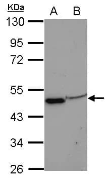Western Blot: EIF3F Antibody [NBP2-16299] - Sample (30 ug of whole cell lysate)  A: A431  B: HepG2  10% SDS PAGE  NBP2-16299 diluted at 1:1000 