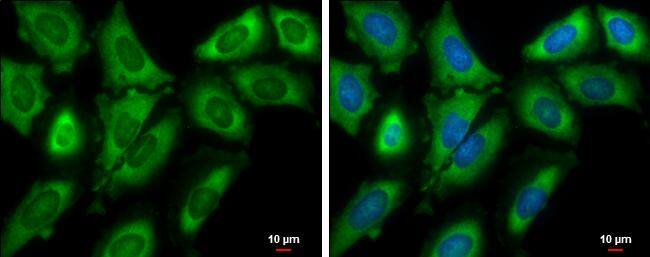 EIF4G3 antibody [N1], N-term detects EIF4G3 protein at cytoplasm by immunofluorescent analysis.Sample: HeLa cells were fixed in 4% paraformaldehyde at RT for 15 min.Green: EIF4G3 protein stained by EIF4G3 antibody [N1], N-term (NBP2-16309) diluted at 1:500.Blue: Hoechst 33342 staining.Scale bar = 10 um. 