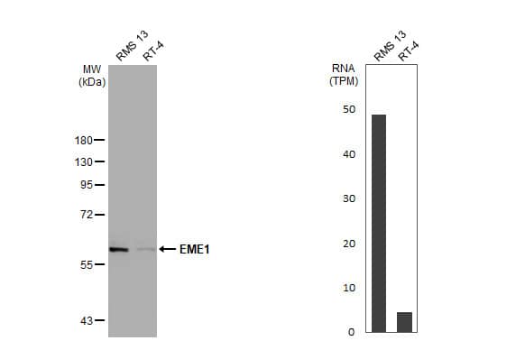 <b>Orthogonal Strategies Validation. </b>Western Blot: EME1 Antibody [NBP2-16325] - Various whole cell extracts (30 ug) were separated by 7.5% SDS-PAGE, and the membrane was blotted with EME1 antibody [N3C2], Internal  diluted at 1:1000. The HRP-conjugated anti-rabbit IgG antibody  was used to detect the primary antibody.Corresponding RNA expression data for the same cell lines are based on Human Protein Atlas program.