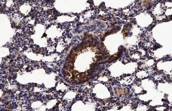 Endothelin B Receptor antibody detects Endothelin B Receptor protein by immunohistochemical analysis.Sample: Paraffin-embedded rat lung.Endothelin B Receptor stained by Endothelin B Receptor antibody (NBP2-16334) diluted at 1:500.Antigen Retrieval: Citrate buffer, pH 6.0, 15 min 