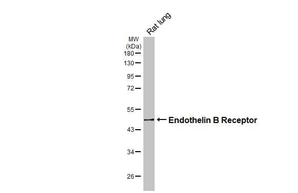 Rat tissue extract (50 ug) was separated by 10% SDS-PAGE, and the membrane was blotted with Endothelin B Receptor antibody (NBP2-16334) diluted at 1:1000. The HRP-conjugated anti-rabbit IgG antibody  was used to detect the primary antibody. 