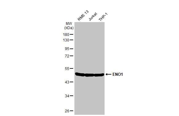 Various whole cell extracts (30 ug) were separated by 10% SDS-PAGE, and the membrane was blotted with ENO1 antibody (NBP2-16337) diluted at 1:3000. The HRP-conjugated anti-rabbit IgG antibody  was used to detect the primary antibody. 