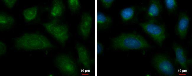 Autotaxin antibody detects Autotaxin protein at cytoplasm by immunofluorescent analysis.Sample: NT2D1 cells were fixed in ice-cold MeOH for 5 min.Green: Autotaxin protein stained by Autotaxin antibody (NBP2-16339) diluted at 1:500.Blue: Hoechst 33342 staining. 