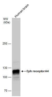 Eph receptor A4 antibody detects Eph receptor A4 protein by western blot analysis. Human tissue extracts (30 ug) was separated by 5 % SDS-PAGE, and the membrane was blotted with Eph receptor A4 antibody (NBP2-16347) diluted by 1:500. 