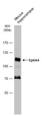 Mouse tissue extract (50 ug) was separated by 7.5% SDS-PAGE, and the membrane was blotted with EphA4 antibody [N3C2], Internal (NBP2-16347) diluted at 1:1000. The HRP-conjugated anti-rabbit IgG antibody  was used to detect the primary antibody. 