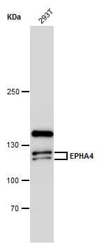 Eph receptor A4 antibody [N3C2-2], Internal detects Eph receptor A4 protein by western blot analysis. Whole cell extracts (30 ug) was separated by 5 % SDS-PAGE, and blotted with Eph receptor A4 antibody [N3C2-2], Internal (NBP2-16348) diluted by 1:1000 