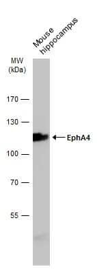 Mouse tissue extract (50 ug) was separated by 7.5% SDS-PAGE, and the membrane was blotted with EphA4 antibody [N3C2], Internal (NBP2-16348) diluted at 1:1000. The HRP-conjugated anti-rabbit IgG antibody  was used to detect the primary antibody. 