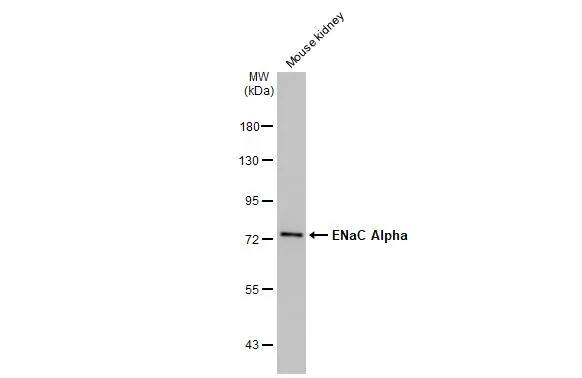 Western Blot: epithelial Sodium Channel alpha Antibody [NBP2-16353] - Mouse tissue extract (50 ug) was separated by 7.5% SDS-PAGE, and the membrane was blotted with epithelial Sodium Channel alpha antibody [N3C2], Internal (NBP2-16353) diluted at 1:1000. The HRP-conjugated anti-rabbit IgG antibody  was used to detect the primary antibody.