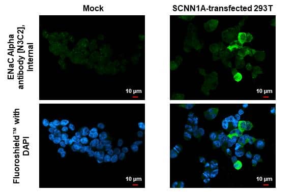 ENaC Alpha antibody [N3C2], Internal detects ENaC Alpha protein by immunofluorescent analysis.Sample: Mock and transfected 293T cells were fixed in 4% paraformaldehyde at RT for 15 min.Green: ENaC Alpha stained by ENaC Alpha antibody [N3C2], Internal (NBP2-16353) diluted at 1:500.Blue: Fluoroshield with DAPI . 