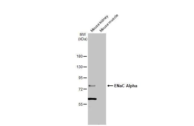 Various tissue extracts (50 ug) were separated by 7.5% SDS-PAGE, and the membrane was blotted with ENaC Alpha antibody [N3C2], Internal (NBP2-16353) diluted at 1:1000. The HRP-conjugated anti-rabbit IgG antibody  was used to detect the primary antibody. 