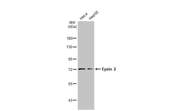 Western Blot: Epsin-2 Antibody [NBP2-16359] - Various whole cell extracts (30 ug) were separated by 7.5% SDS-PAGE, and the membrane was blotted with Epsin-2 antibody [N1C1] (NBP2-16359) diluted at 1:1000. The HRP-conjugated anti-rabbit IgG antibody  was used to detect the primary antibody.