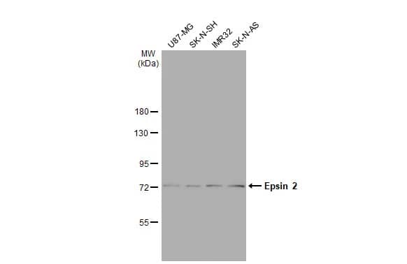 Western Blot: Epsin-2 Antibody [NBP2-16359] - Various whole cell extracts (30 ug) were separated by 7.5% SDS-PAGE, and the membrane was blotted with Epsin-2 antibody [N1C1] (NBP2-16359) diluted at 1:1000. The HRP-conjugated anti-rabbit IgG antibody  was used to detect the primary antibody.