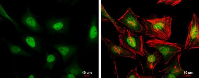 ERF antibody detects ERF protein at nucleus by immunofluorescent analysis.Sample: HeLa cells were fixed in 4% paraformaldehyde at RT for 15 min.Green: ERF stained by ERF antibody (NBP2-16366) diluted at 1:500.Red: phalloidin, a cytoskeleton marker, diluted at 1:100.Scale bar= 10um. 