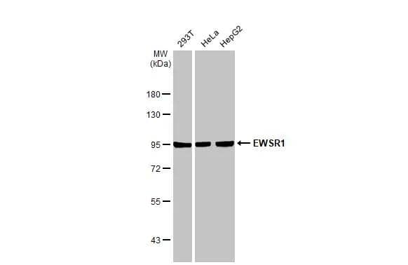 Various whole cell extracts (30 ug) were separated by 7.5% SDS-PAGE, and the membrane was blotted with EWSR1 antibody (NBP2-16389) diluted at 1:2000. The HRP-conjugated anti-rabbit IgG antibody  was used to detect the primary antibody. 