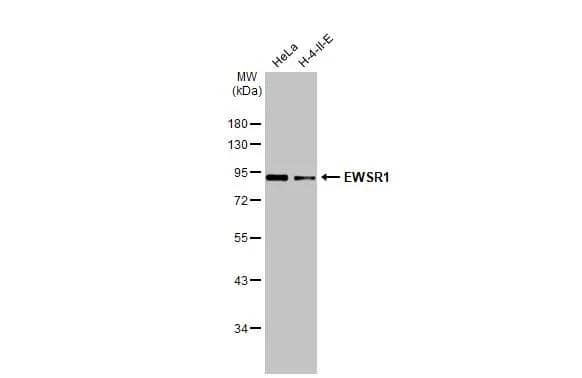 Various whole cell extracts (30 ug) were separated by 10% SDS-PAGE, and the membrane was blotted with EWSR1 antibody (NBP2-16389) diluted at 1:1000. The HRP-conjugated anti-rabbit IgG antibody  was used to detect the primary antibody. 