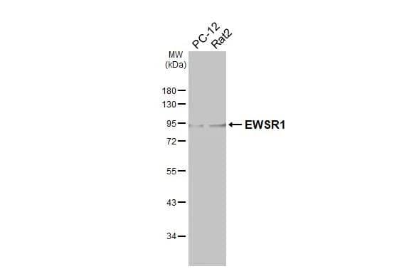 Various whole cell extracts (30 ug) were separated by 10% SDS-PAGE, and the membrane was blotted with EWSR1 antibody (NBP2-16389) diluted at 1:1000. The HRP-conjugated anti-rabbit IgG antibody  was used to detect the primary antibody. 