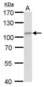 EXOC2 antibody detects EXOC2 protein by Western blot analysis.A. 30 ug MCF-7 whole cell lysate/extract7.5 % SDS-PAGEEXOC2 antibody (NBP2-16390) dilution: 1:1000 