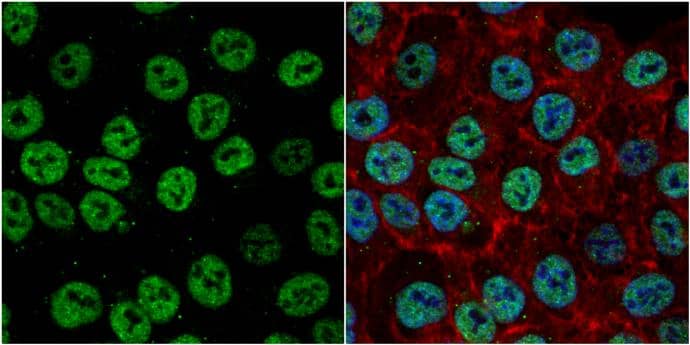 Exonuclease 1 antibody detects Exonuclease 1 protein at nucleus by immunofluorescent analysis.Sample: HCT116 cells were fixed in 4% paraformaldehyde at RT for 15 min.Green: Exonuclease 1 protein stained by Exonuclease 1 antibody (NBP2-16391) diluted at 1:1000.Red: phalloidin, a cytoskeleton marker, stained by phalloidin (invitrogen, A12380) diluted at 1:200.Blue: Hoechst 33342 staining. 