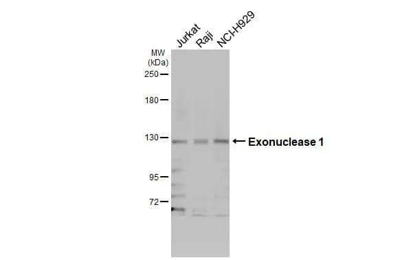 Various whole cell extracts (30 ug) were separated by 5% SDS-PAGE, and the membrane was blotted with Exonuclease 1 antibody (NBP2-16391) diluted at 1:1000. The HRP-conjugated anti-rabbit IgG antibody  was used to detect the primary antibody. 